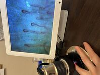 高濃度水素ガス吸入のお勧め